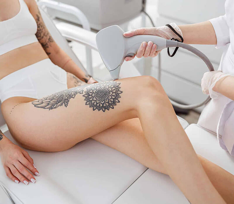 Chemical Peels Treatment in South Delhi